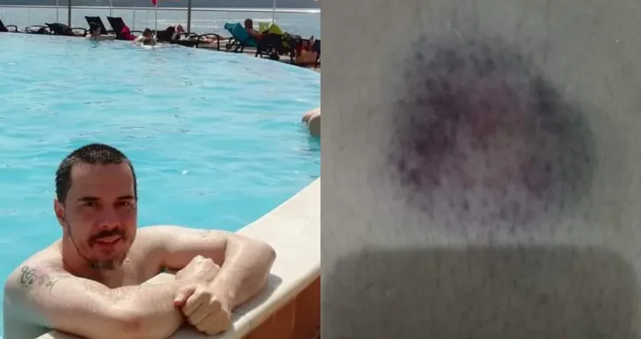 Crnogorski pjevač pozvao Srbe, muslimane i Crnogorce da ne idu u Neum: Brutalno sam pretučen zbog pjesme