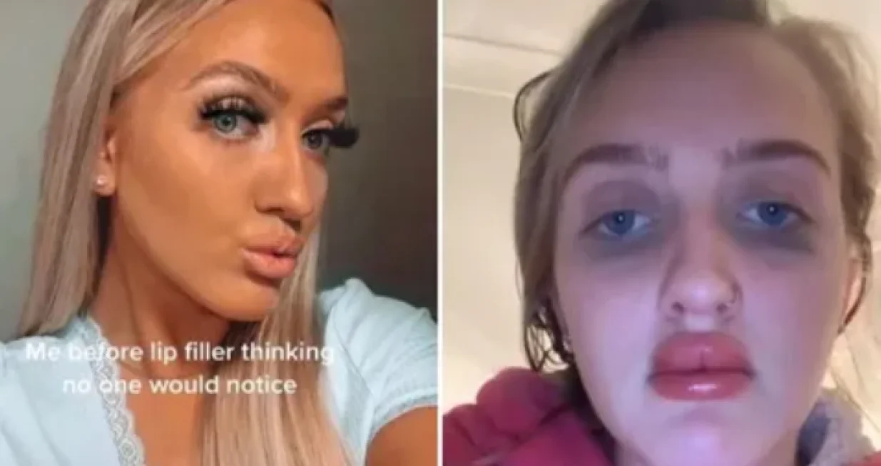 Neuspjela plastična operacija/