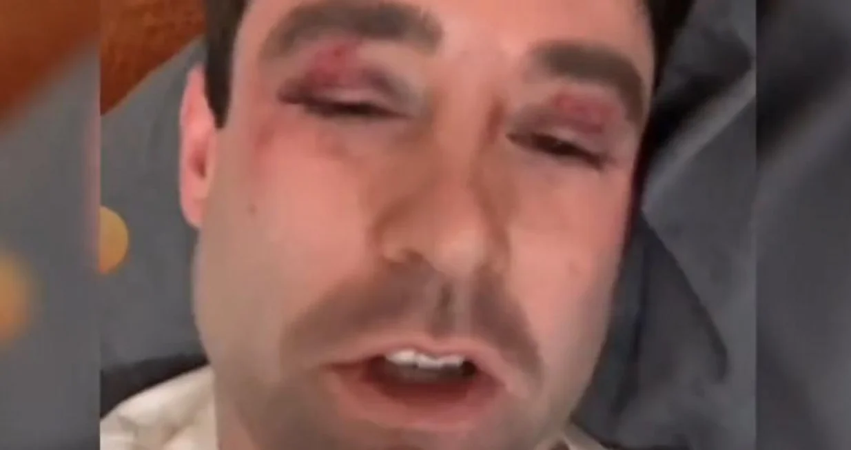 Klotz: "Gdje su uopće roditelji tih klinaca? Nedopustivo je da im djeca ovako usred noći tuku ljude"/