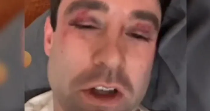 Klotz: "Gdje su uopće roditelji tih klinaca? Nedopustivo je da im djeca ovako usred noći tuku ljude"/