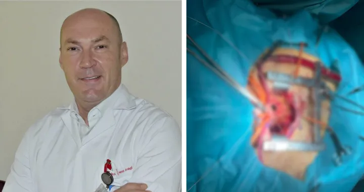 Dr. med. sc. Harun Avdagić, operativni zahvat - Mini Bentall, UKC Tuzla/Ukc Tuzla