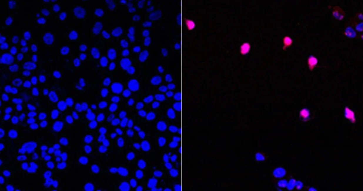 Neliječene stanice raka i stanice tretirane novim lijekom/