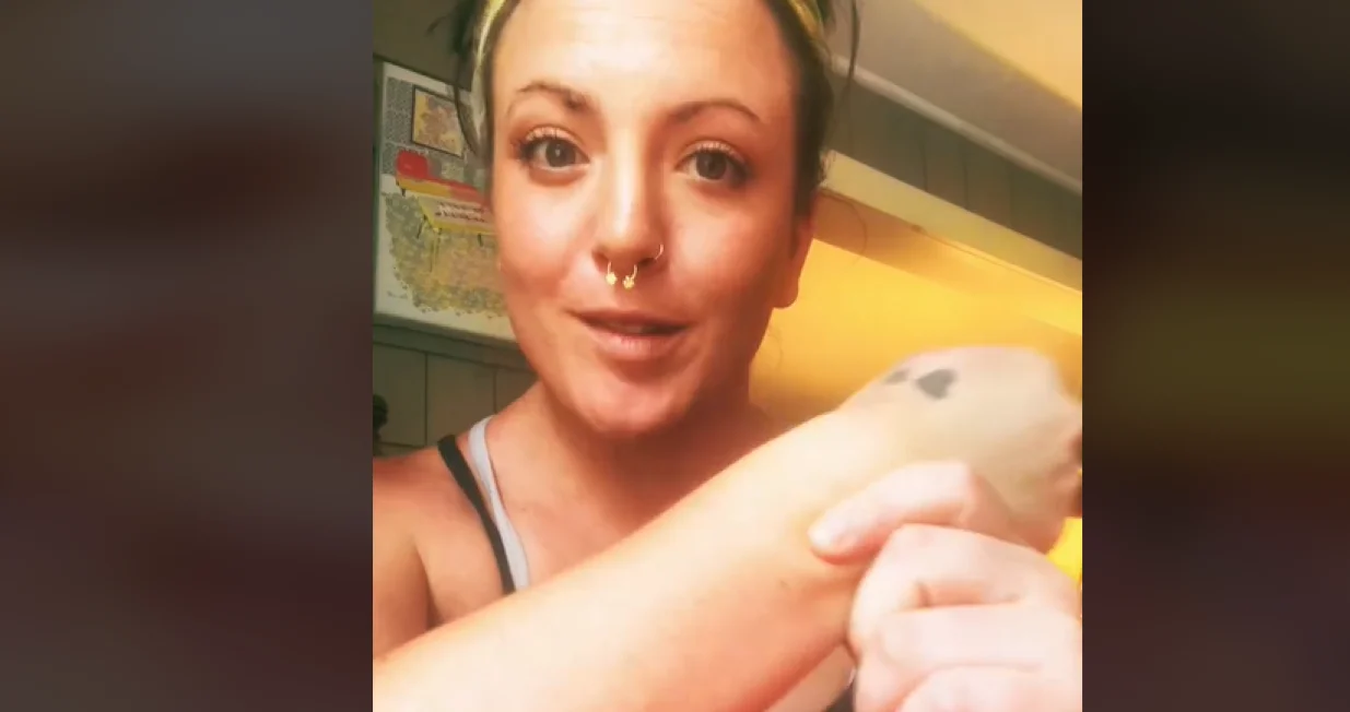 Ova djevojka živi bez pulsa/PrtSc/Tiktok/