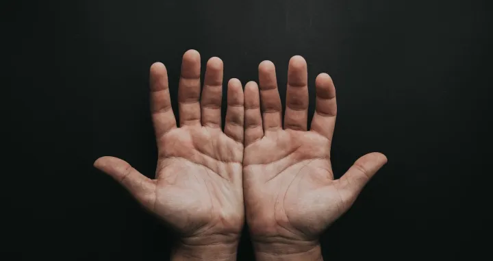 Zašto se očekuje dobitak kada jedan dlan svrbi a drugi ne? /Pexels/