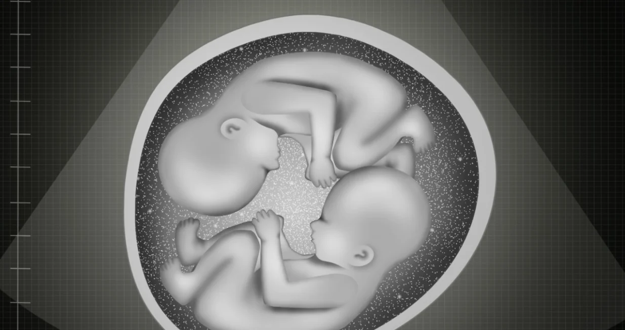 U prosjeku se jednojajčani blizanci razlikuju za 5.2 genetičke promjene/