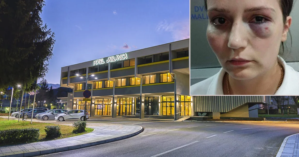 Enisa Klepo se požalila na uslove rada u hotelu i dobila batineod vlasnika/