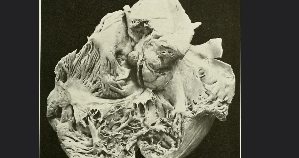 Kalcifikacija srca/ Studies in cardiac pathology/