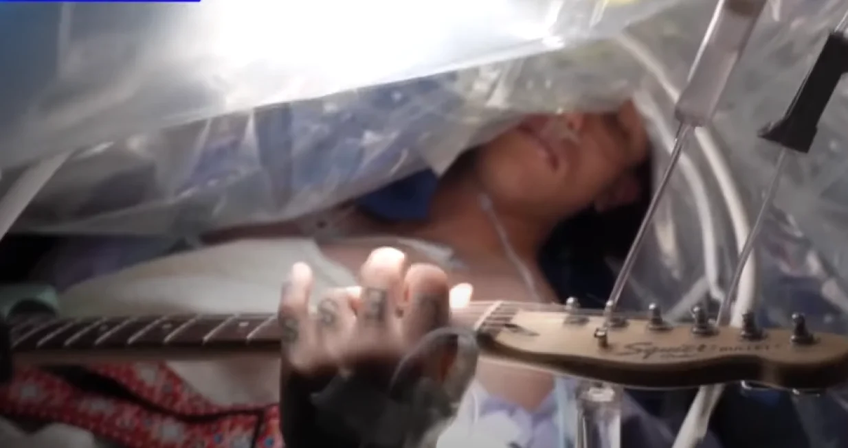 Pacijent je bio primoran ostati budan tokom operacije mozga/ Screenshot/ Youtube/