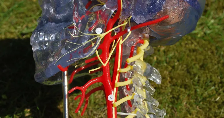 Karotidne arterije su naročito osjetljive na mikroplastiku/ Wikimedia Commons/