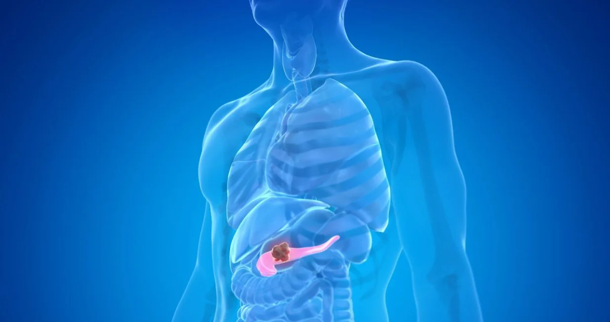 Ovaj rak je jedan od najgorih/ Canva/Amir9937