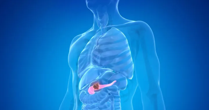 Ovaj rak je jedan od najgorih/ Canva/Amir9937