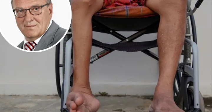 Poliomielitis ostavlja trajne posljedice kod djece/Almir Sarenkapa