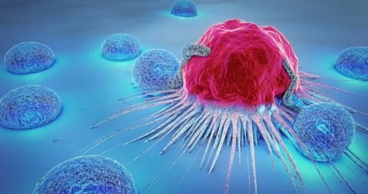 Hrvatski naučnici otkrili način narušavanja širenja karcinoma debelog crijeva/