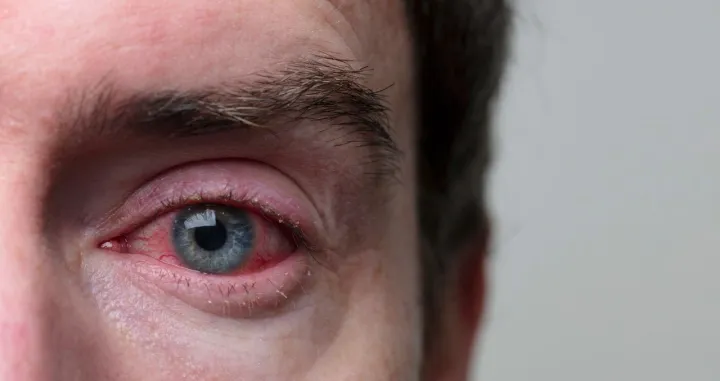 Da li vaša ishrana uzrokuje nesanicu?/Amir9937