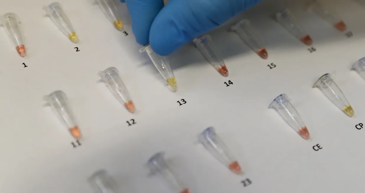 epa08730816 View of the extraction of the genetic code or ribonucleic acid (RNA) of the coronavirus, the same that is amplified to continue with the processing and achieve the result by means of a color reaction, positive yellow, negative red, in the laboratory of Hipolito Unanue Hospital, in Lima, Peru, 08 October 2020. The hospital is the second in Peru to launch the use of rapid molecular tests, a new technology that saves time to detect the presence of the virus in a similar way to PCR. These molecular tests, the results of which are ready in about 45 minutes, use the RT-LAMP technique (loop-mediated isothermal amplification), a method that is usually applied in Peru for the diagnosis of dengue, Zika and tuberculosis. EPA/Paolo Aguilar/Paolo Aguilar