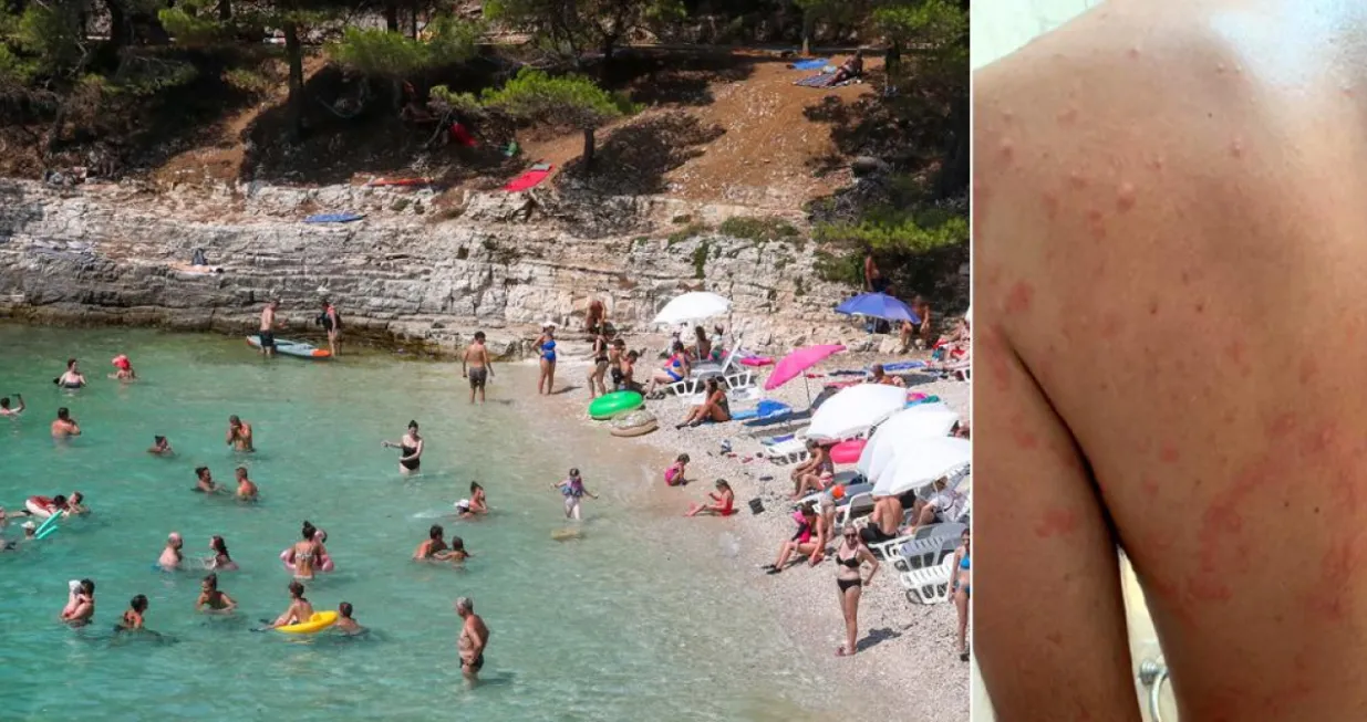 turisti hrvatska grinje/