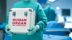 transplantacija organa/