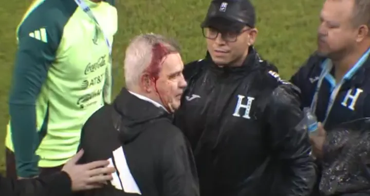 Javier Aguirre povreda 