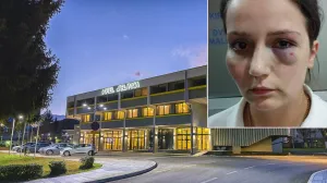 Enisa Klepo se požalila na uslove rada u hotelu i dobila batineod vlasnika/
