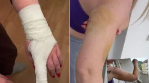 Drama u Mostaru: Amar sa ocem i amidžom pretukao suprugu pred djecom/Facebook