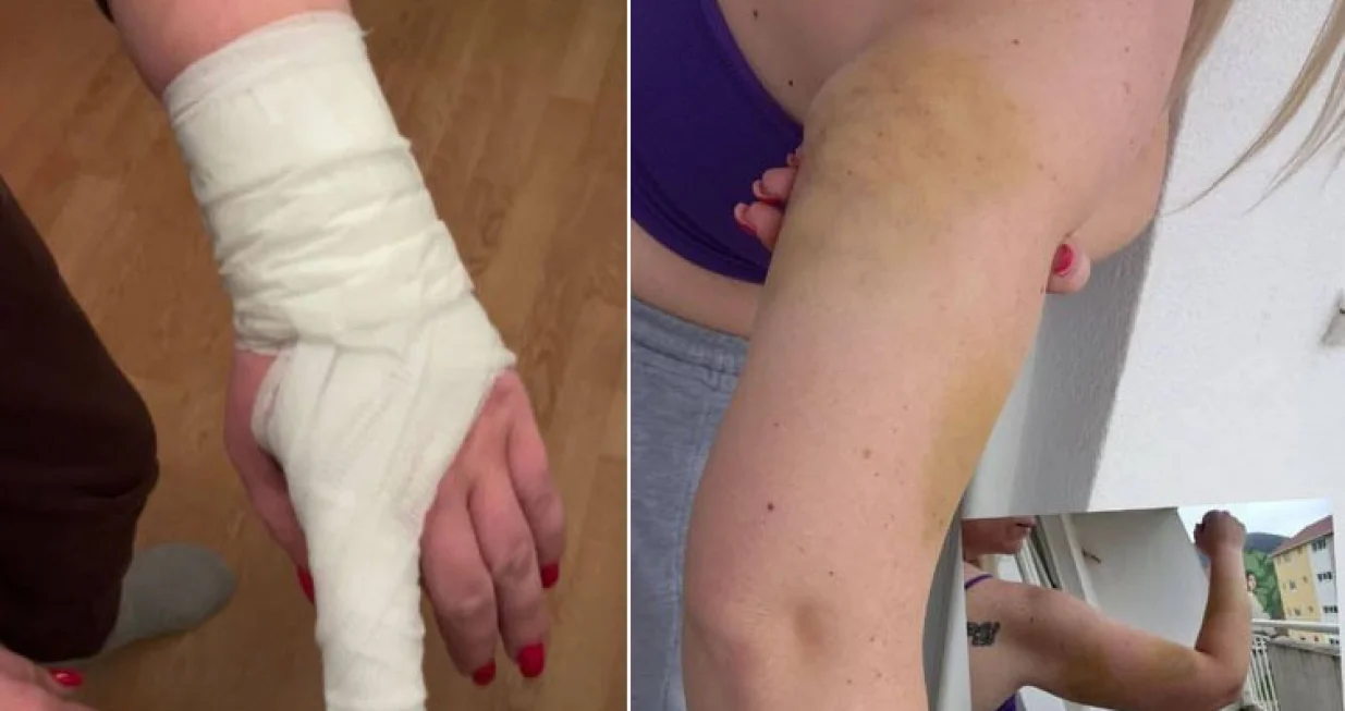 Drama u Mostaru: Amar sa ocem i amidžom pretukao suprugu pred djecom/Facebook