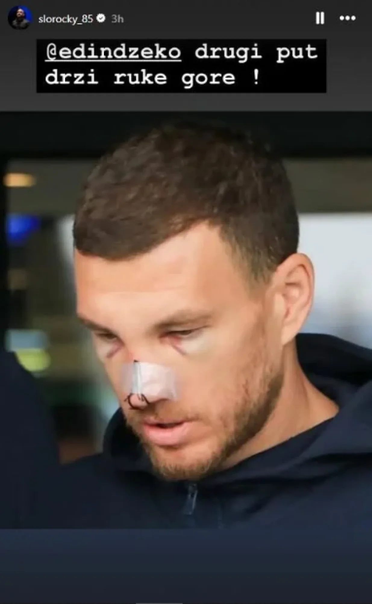 Poruka Fabjana za Džeku