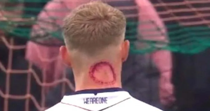 Jeziv ožiljak na vratu igrača Bologne (FOTO: X)