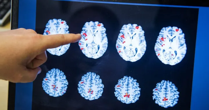 pu&scaron;tali Matrix/