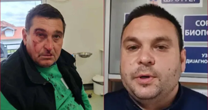 OTAC i sin, Bane i Aca Jevtić, pretučeni su danas u selu Krćevac, na izlazu iz Topole, nakon što je Aca ljudima koji su išli na miting u Beograd dobacio: "Pumpaj, pumpaj." Stariji Jevtić zadobio je prijelome kostiju lica i nosa te je hospitaliziran u Kliničkom centru u Kragujevcu./N1