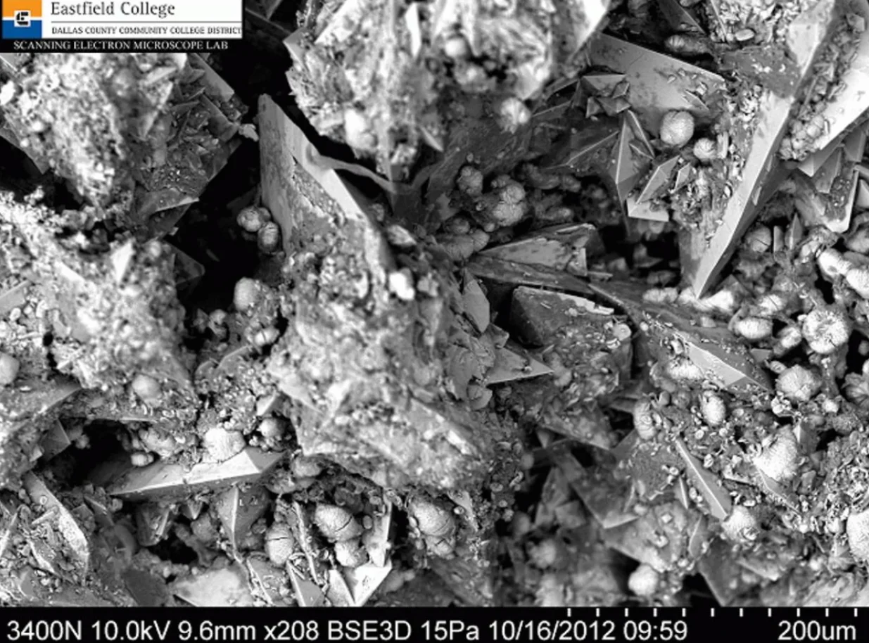 Bubrežni kamenci pod mikroskopom/Murry Gans