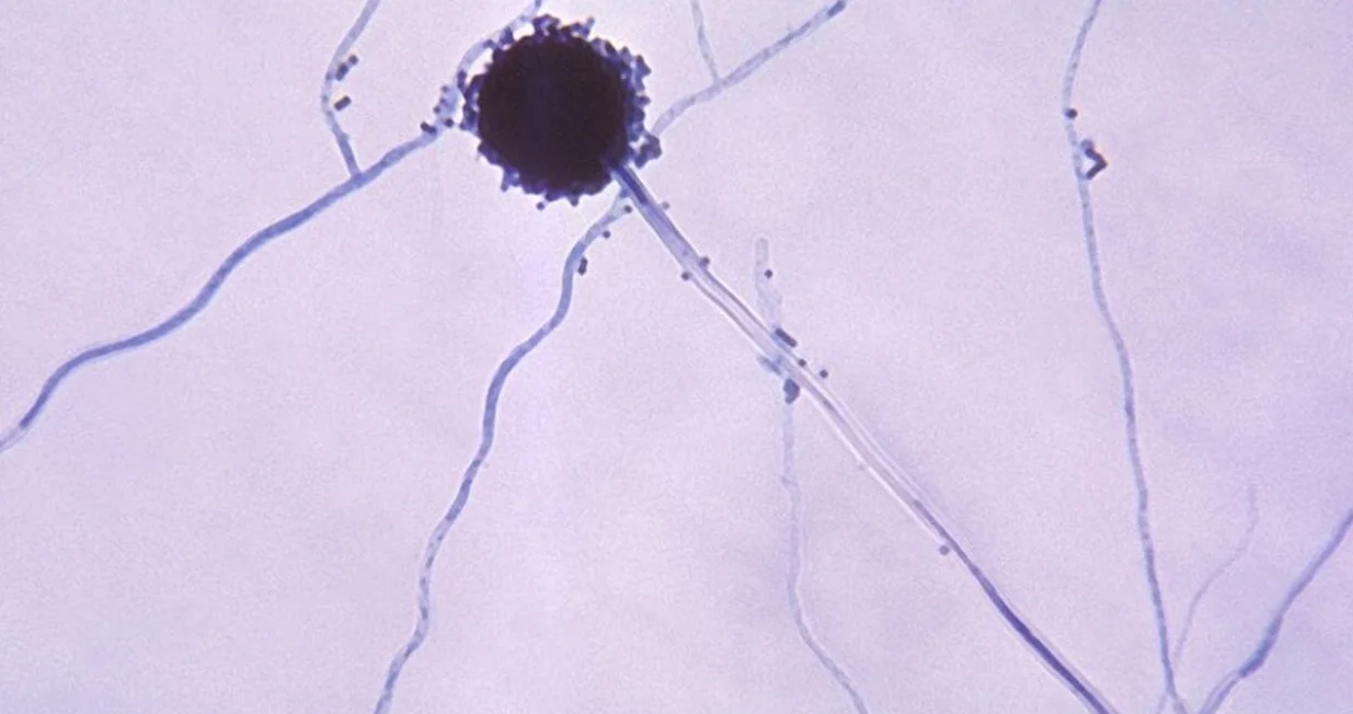 Aspergillus, vrsta plijesni koja može izazvati razne tegobe/Centres For Disease Control And Prevention