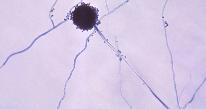 Aspergillus, vrsta plijesni koja može izazvati razne tegobe/Centres For Disease Control And Prevention