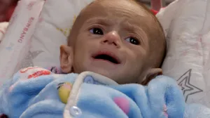 A Palestinian girl lies on a bed at Nasser Hospital where she receives treatment, in Khan Younis, in the southern Gaza Strip, April 30, 2025. REUTERS/Hatem Khaled  TPX IMAGES OF THE DAY/Hatem Khaled