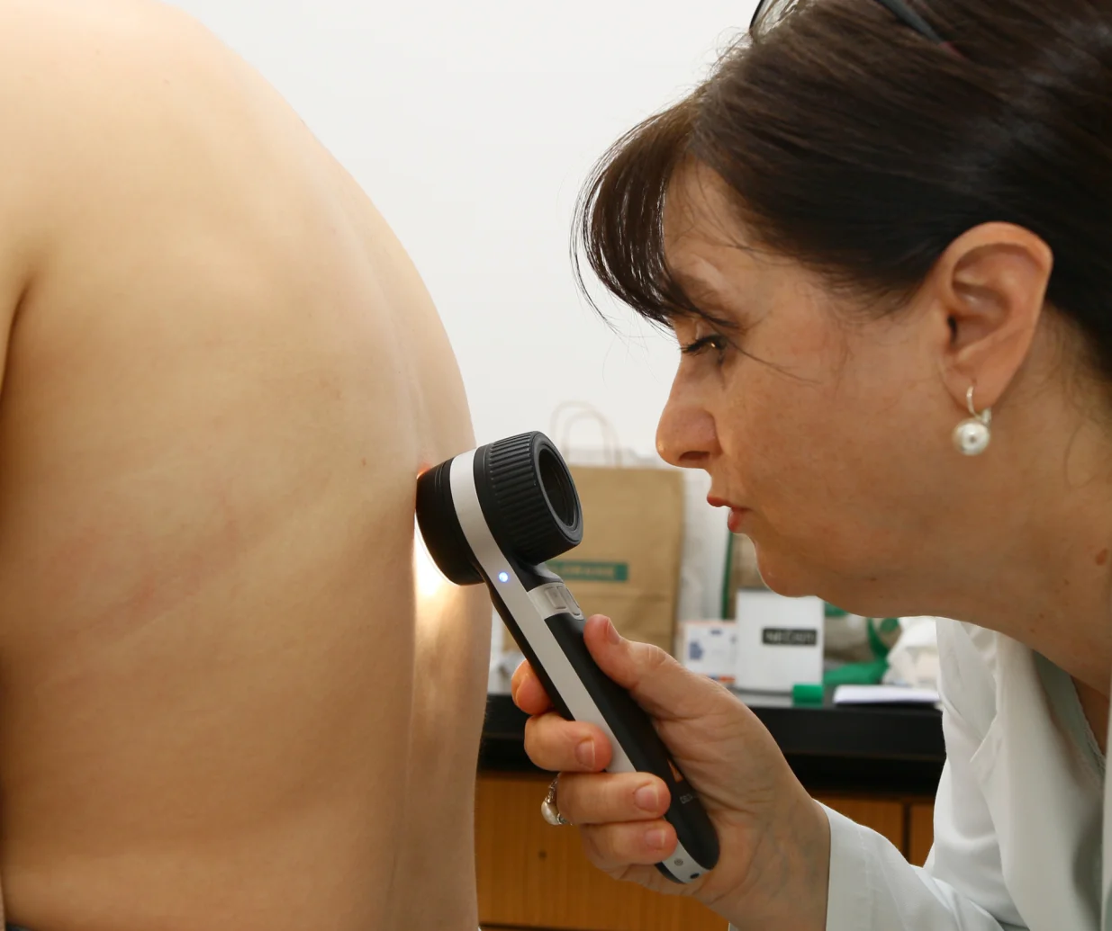 besplatan pregled kože u Zenici/Muhamed Tunović