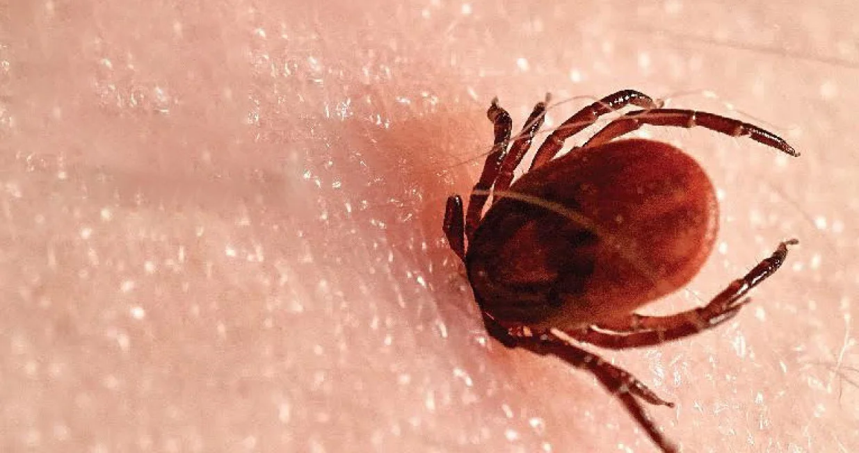 krpelj, šta učiniti ako vas ubode/