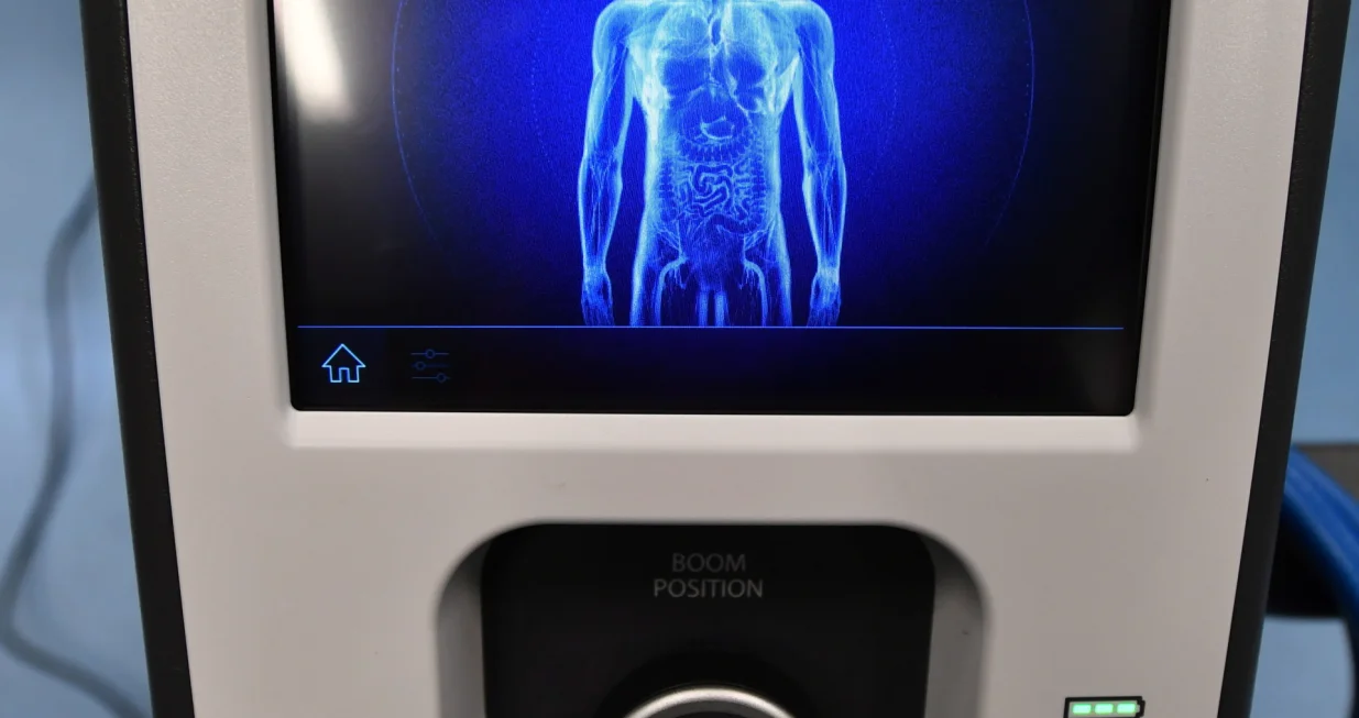 epa08628875 Presentation of the 'da Vinci' robotic system in the newly established Clinical Center for Robotic Operations of the Pomeranian Medical University in Szczecin, Poland, 27 August 2020. The hospital in Szczecin is the second clinical hospital in Poland where surgeons will use this innovative technology. The medical center in Szczecin plans to use the 'da Vinci' robot for general surgery, as well as in urological and gynecological surgeries and in the treatment of patients suffering from oncological diseases. EPA/MARCIN BIELECKI POLAND OUT/Marcin Bielecki