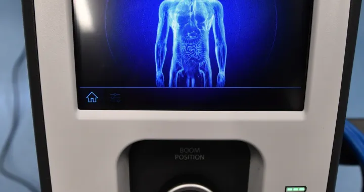 epa08628875 Presentation of the 'da Vinci' robotic system in the newly established Clinical Center for Robotic Operations of the Pomeranian Medical University in Szczecin, Poland, 27 August 2020. The hospital in Szczecin is the second clinical hospital in Poland where surgeons will use this innovative technology. The medical center in Szczecin plans to use the 'da Vinci' robot for general surgery, as well as in urological and gynecological surgeries and in the treatment of patients suffering from oncological diseases. EPA/MARCIN BIELECKI POLAND OUT/Marcin Bielecki