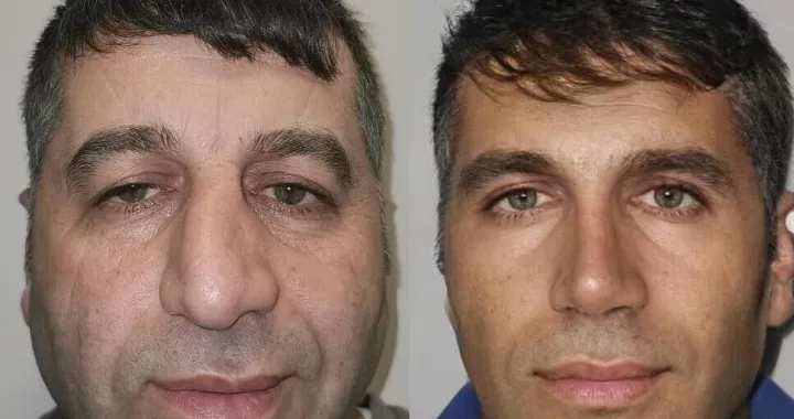 Izgleda kao totalno drugi čovjek/Este Istanbul