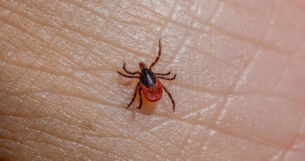 Izvucite krpelja bez brige/Pexels