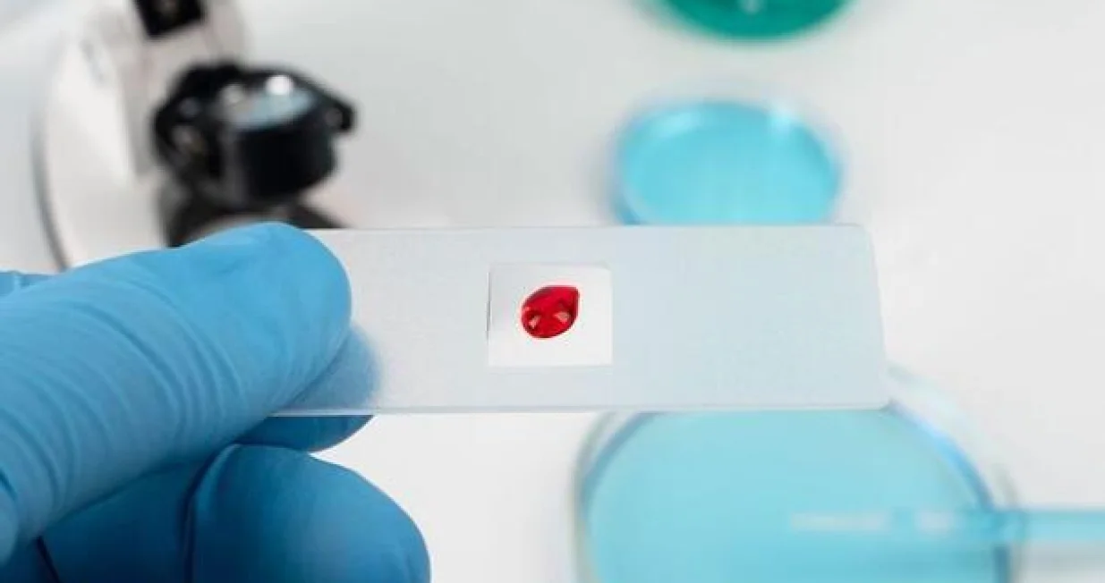 HIV/AIDS ilustracija/