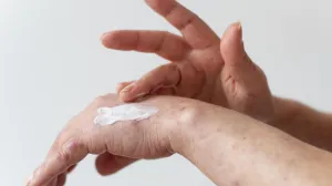 Ovo su najčešći osipi tokom ljeta/Free Pik