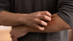 Prirodni trik protiv komaraca/Free Pik