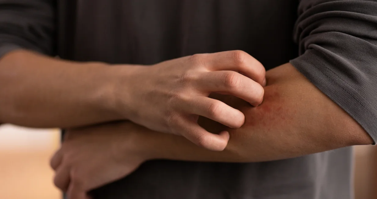 Prirodni trik protiv komaraca/Free Pik