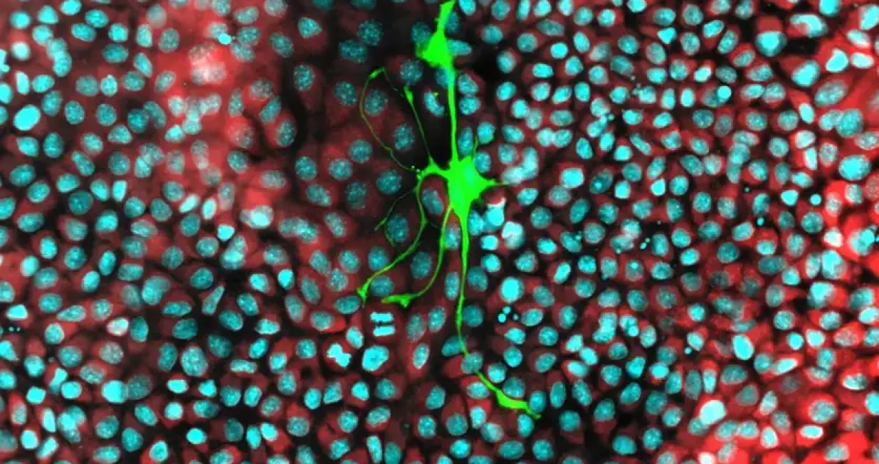 Živčana ćelija (obojena zeleno) koja raste unutar kulture ćelija rakaSimon Grelet i Gustavo Ayala/