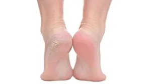 Recite zbogom grubim petama/Pinterest