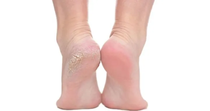 Recite zbogom grubim petama/Pinterest