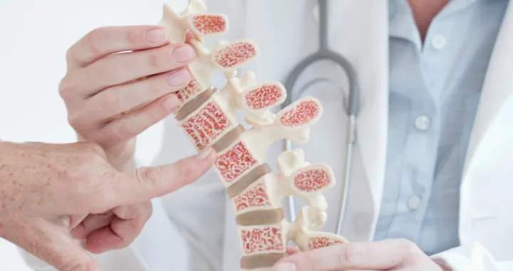 osteoporoza, kosti, leđa, bolovi/Ms.medicine