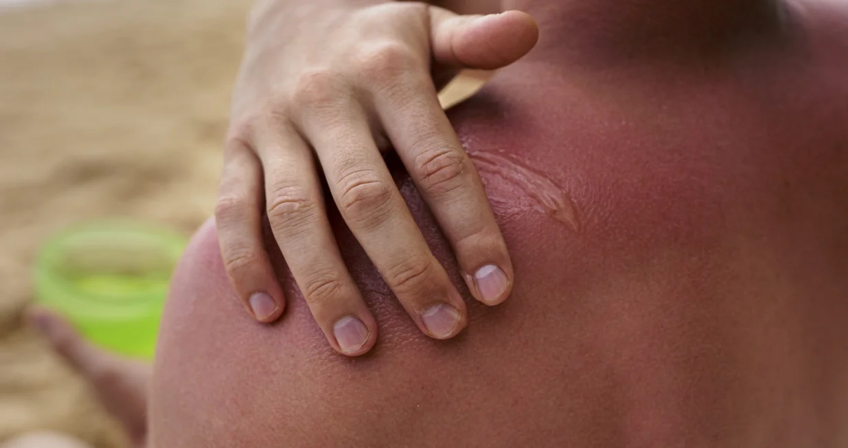 Jednostavan recept, moćan efekat/Free Pik