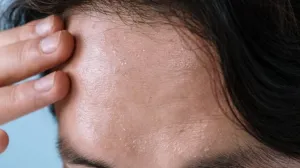 Samo pogoršavaju stvar/Pexels