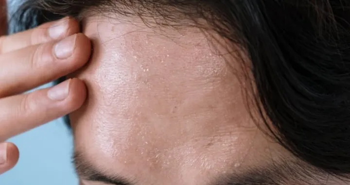 Samo pogoršavaju stvar/Pexels